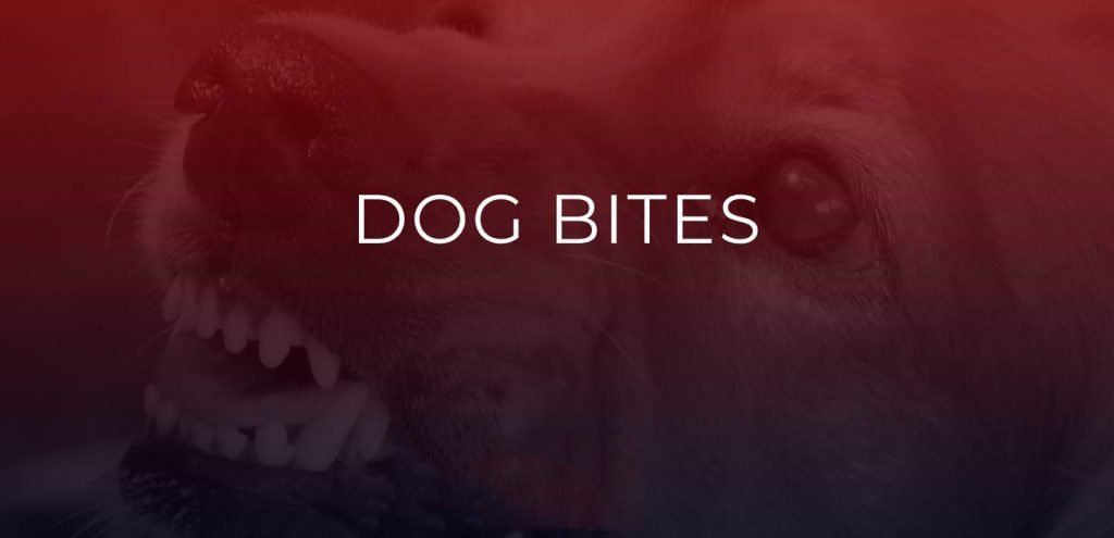 Lawyer For A Dog Bite