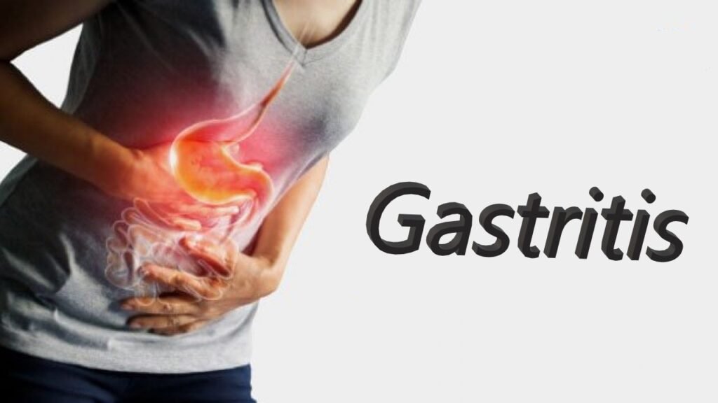 Gastritis