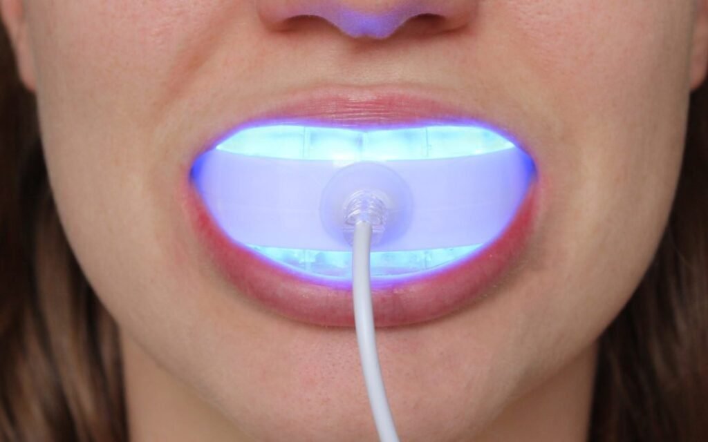 led-teeth-1080x675